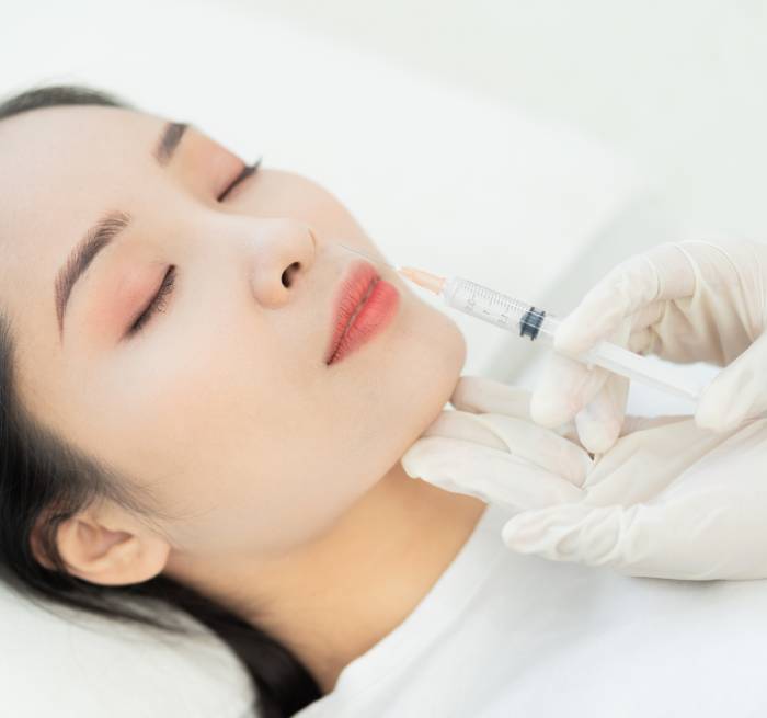 ボトックス治療